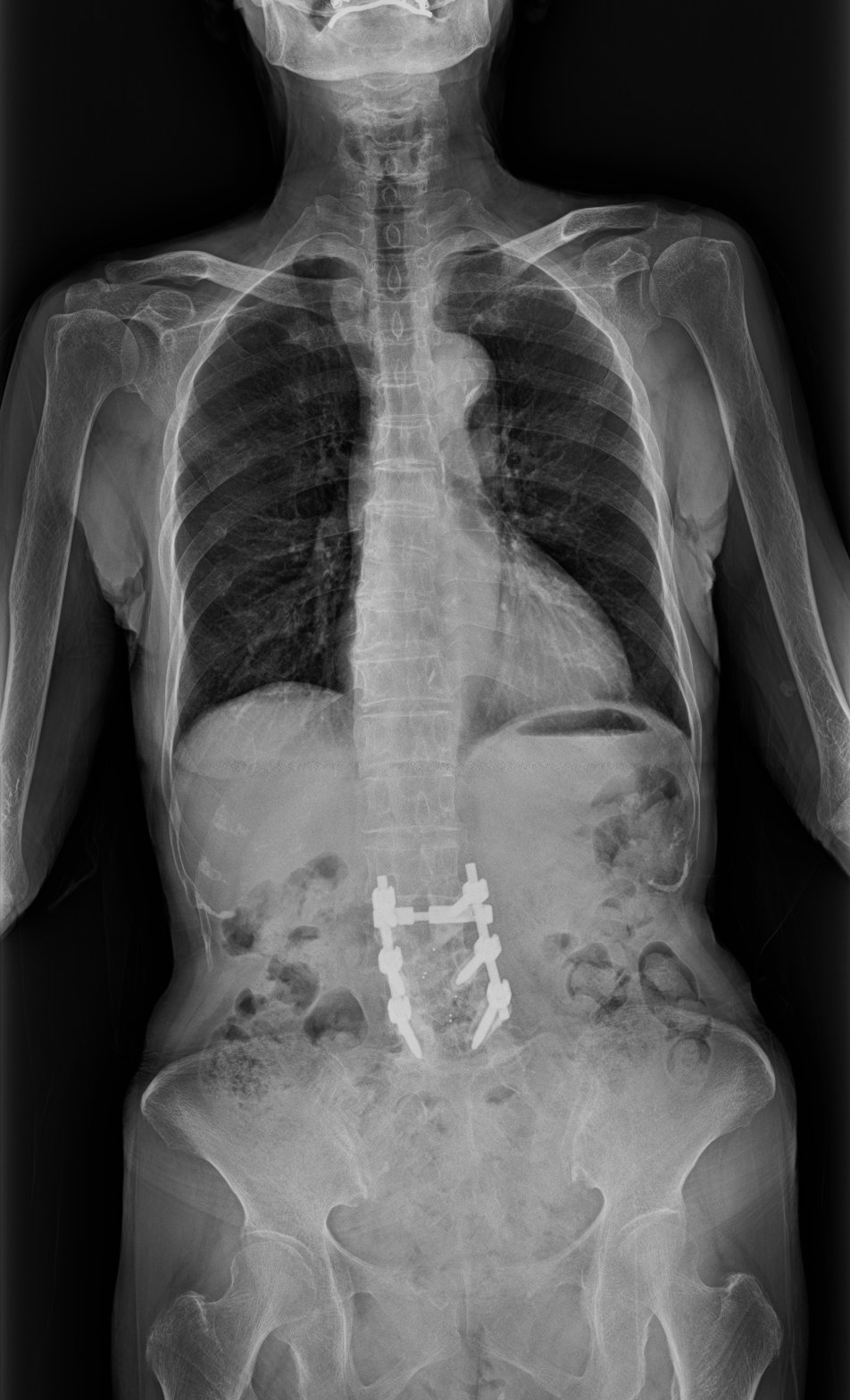 长度的进步数码摄影为可视化创造机会在脊柱手术中,以及预处理和胸。图片由富士胶片医疗系统