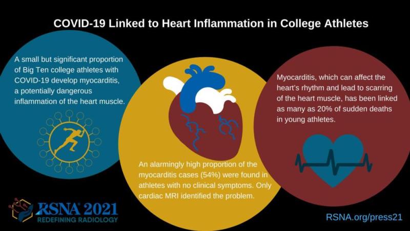 这张信息图显示了COVID-19与大学生运动员心脏炎症的关系。