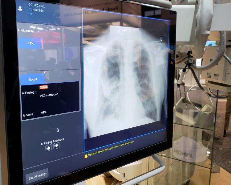 通用电气医疗集团演示实验X-ray-based算法,设计成嵌在其高端便携式x光机,Optima XR240amx