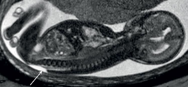 胎儿MRI图像滑块