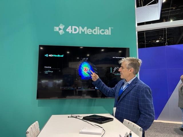 医疗技术公司4D medical的创始人兼首席执行官安德烈亚斯·福拉斯解释了在RSNA 2022上公布的XV扫描仪的功能。