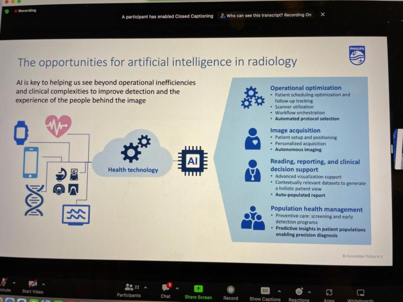 在RSNA22期间的飞利浦医疗保健虚拟圆桌会议上，诊断和路径信息学总经理Reema Poddar讨论了人工智能在放射学中的机会。飞利浦在这里介绍了其下一代高级可视化工作空间平台，该平台支持人工智能算法和工作流程。这项最新的创新是供应商中立的，为心脏病学、肿瘤学、神经学和放射学的多种模式提供了一个单一、先进的平台