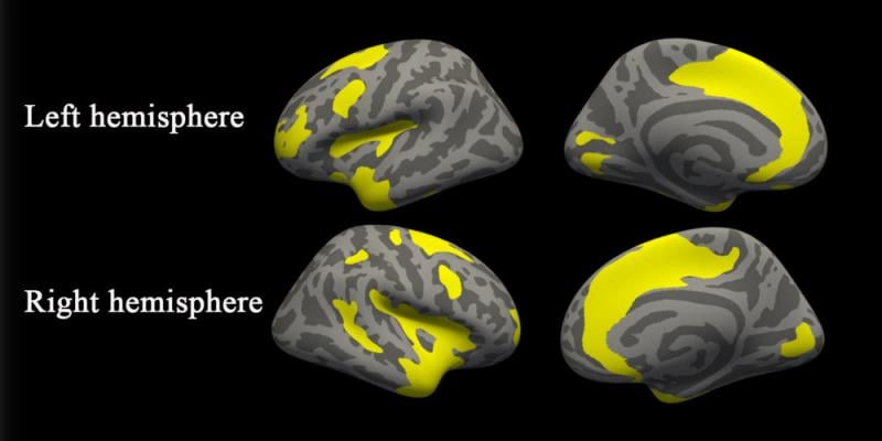 MRI揭示大脑异常患者抑郁和焦虑