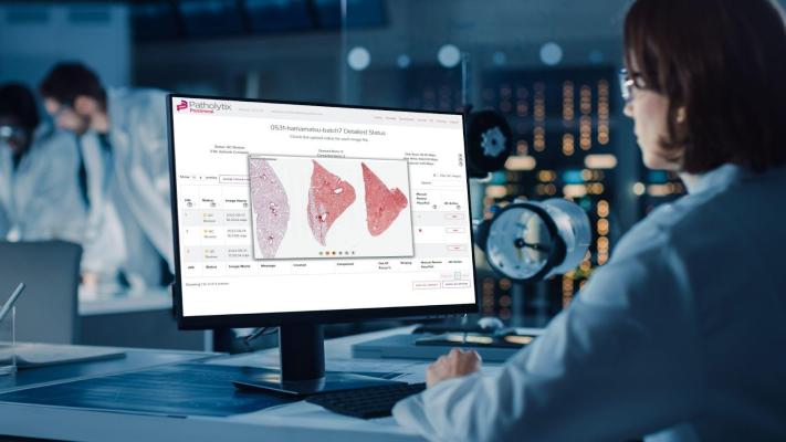 Deciphex,一个位于都柏林的软件公司专注于发展数字pathology-based软件和服务临床和病理的研究,已宣布推出其自动化图像质量控制(QC)数字病理研究。