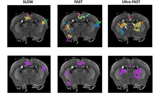 新的核磁共振技术接近实时地捕捉大脑的变化