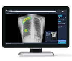 软件将嵌入爱克发的音乐工作站,提供摘录一个直观的界面和公认的放射科医师社区良好的图像质量。