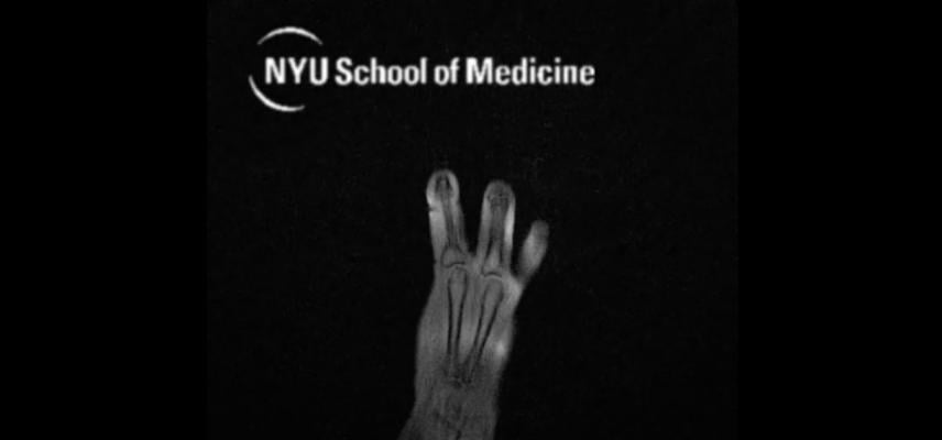 MRI“手套”提供了新的观察手解剖学