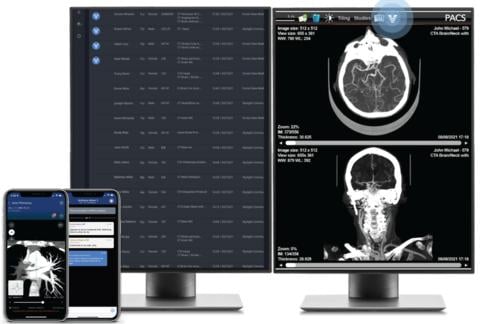 Viz Radiology Suite的屏幕截图，包括工作列表和PACS集成(图片来源:Business Wire)
