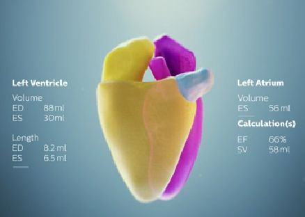飞利浦Epiq 7,在解剖学上智能超声波,aiu、心脏超声检查