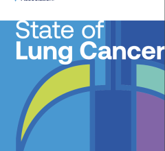 美国肺肺协会的2022年“肺癌状况”报告审查了美国各地的关键指标，包括新发病例、生存率、早期诊断、手术治疗、缺乏治疗和筛查率。