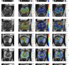 滑铁卢大学工程师发明的MRI显示比许多现有的成像技术COVID-19如何改变人类的大脑。