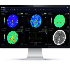 临床验证的MR脑灌注图像支持早期诊断，指导肿瘤活检和术后监测