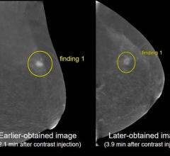 发现从科学网上的海报在2023年提出的arr年度会议在夏威夷会议中心显示在投影秩序和制度变化图像采集时机增强对比度乳房x光检查(CEM)协议