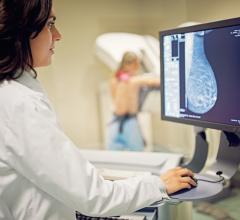DenseBreast-info.org已发表声明即USPSTF准则不应适用于致密乳房的女性,说明新发布的美国预防服务工作组(USPSTF)乳腺癌筛查建议为女性写的“平均”患乳腺癌的风险