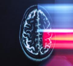 麻省理工学院的研究人员使用一种专门的核磁共振传感器，证明他们可以探测到大脑等组织深处的光。