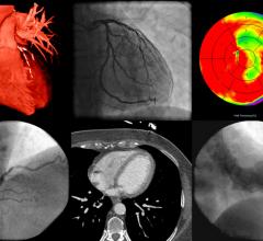 发表在《放射学:心胸影像学》上的一项关于过去十年心脏成像趋势的新研究报告称，从2010年到2019年，医院门诊部放射科医生进行冠状动脉计算机断层摄影血管造影(cCTA)检查的比例显著增加，表明该技术的光明前景。