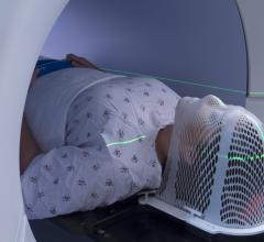 根据一项新的研究，暴露在低剂量电离辐射下的人在一生中有额外的，但适度的患心脏病的风险