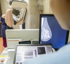 第三个研究从DenseBreast-info.org显示医疗服务提供者之间的知识差距对乳腺癌风险模型和高危筛查的建议