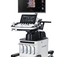 赫拉W10精英特征与更新ergonomic-friendly设计和优化成像功能驱动的诊断信心。(照片:业务线)