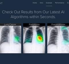 Lunit Insight为胸部x光片提供基于云的AI分析