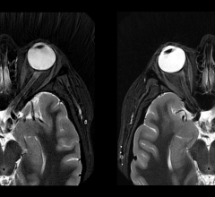 扩展深度上优于空中侦察DL兼容性3 d和螺旋桨有可能使患者在MRI诊断更有信心