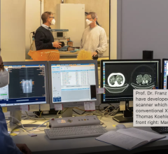 教授弗朗茨·普费弗博士(回来,左)生物医学物理,教授和他的团队开发了一个原型暗场相结合的临床CT扫描仪和传统x射线技术(回正确的:托马斯·克勒博士,前左:克莱门斯施密德,前面右:Manuel Viermetz)。