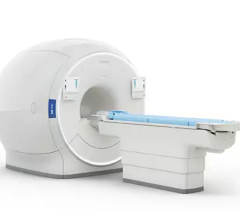 飞利浦氙气启用MRI结合XENOVIEW从Polarean可以提供位肺脏,外科医生和呼吸道专家与区域地图的通风病人的肺部协助更好地管理疾病状态