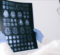 科学家们发现一种新的用于铜在磁共振成像(MRI)造影剂的设计,有助于创建更好的图片,帮助医生诊断病人的条件下更容易和安全。