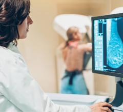 Transpara的性能研究的主题是本周在RSNA,有两个研究表明潜在的Transpara安全地减少工作量的临床工作流double-reading乳腺癌筛查项目。