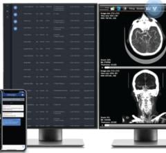 Viz Radiology Suite的屏幕截图，包括工作列表和PACS集成(图片来源:Business Wire)