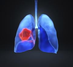 这个行业正在经历一种动量从行业领导者,帮助扩大肺筛查项目